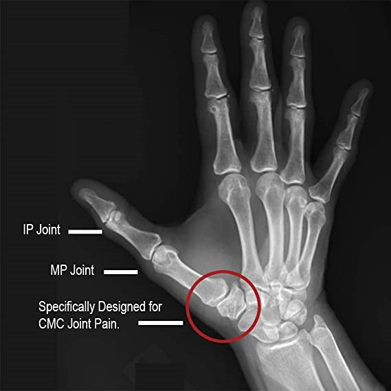 Comfort Cool Thumb CMC Restriction