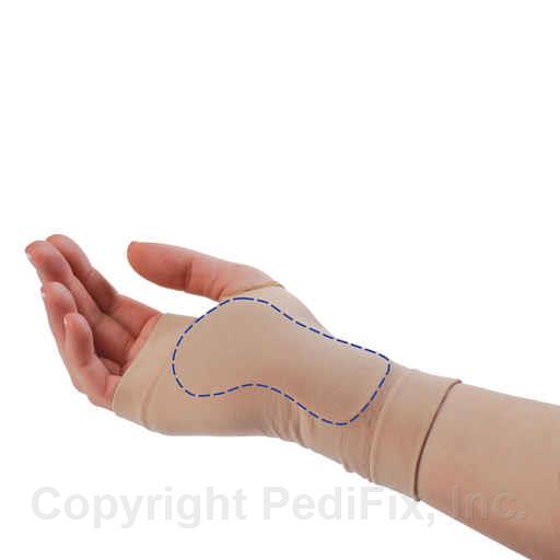 PediFix Visco-GEL Carpal Tunnel Relief Sleeve